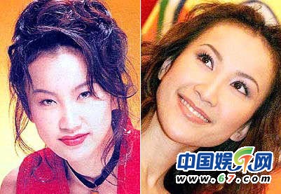 一線女星豪門臉整容內幕
