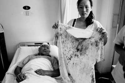 兩寶馬男險撞環衛工 將其打致噴血后逃逸