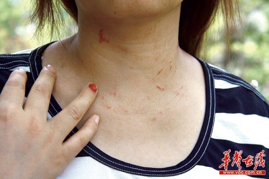 妻子現場抓住小三 竟被丈夫開車拖行百米