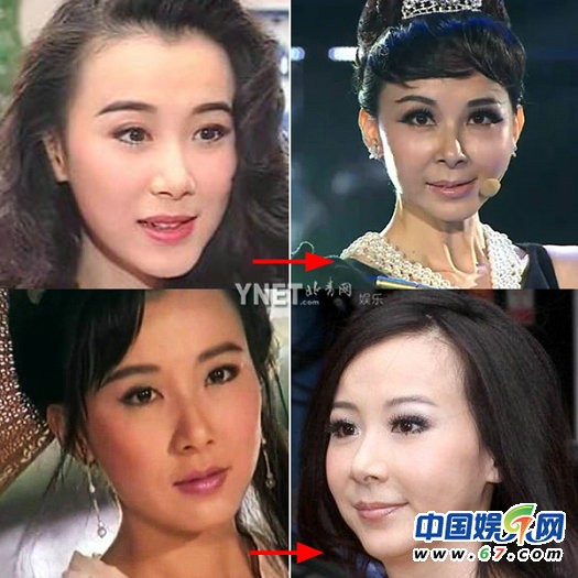 女星裝嫩未遂顯老態