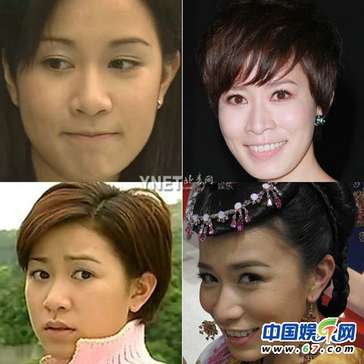 女星裝嫩未遂顯老態