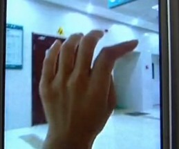 女子曬襪子滴水被親戚掰斷手指 造型詭異難復位