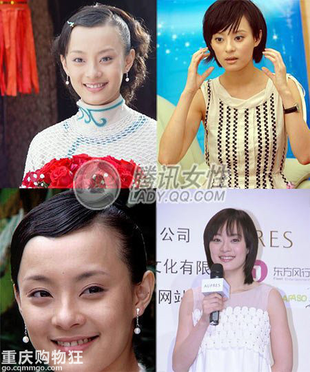 整容不是萬能的 盤點明星整容也去不掉的小缺陷