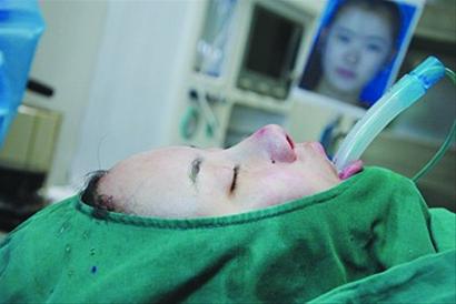 妙齡女沒當上空姐發誓整容 砸15萬挨11刀