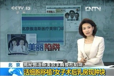 女孩傲洛斯豐胸術后乳房現腫塊 揭豐胸陷阱